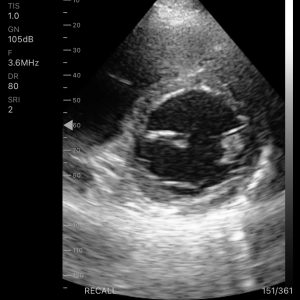 Wireless USG Cardiac